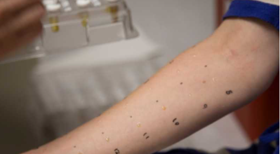 alergia a medicamentos
