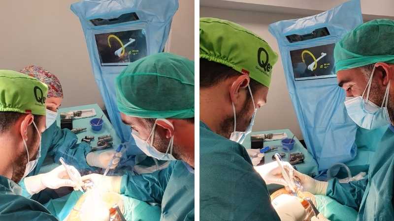 artroplastia
