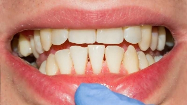 regeneracion dental