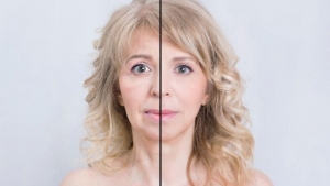 antes y después